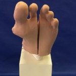 Podiatric Forefoot Trainer